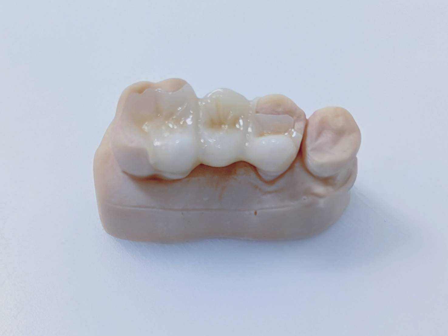 審美的歯科治療とは